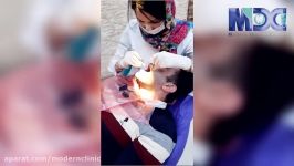 تحویل روکش ایمپلنت دندان کلینیک دندانپزشکی مدرن