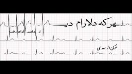 هر دلارام دید دلش آرام رفت