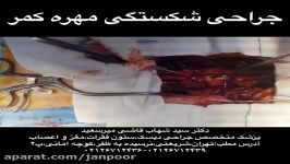 کلیپ پزشکی جراحی شکستگی کمر،دکتر میرسعید،بهترین جراح ستون فقرات در ایران26712436