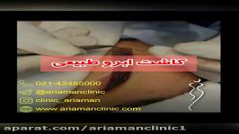 فیلم مراحل کاشت ابرو در کلینیک آریامن