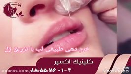 تزریق ژل لب فرم دهی طبیعی لب تزریق ژل کلینیک اکسیر