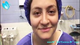 قبل بعد عمليات التجميل الانف في ايران  عملية تجميل الانف  دكتور تجميل