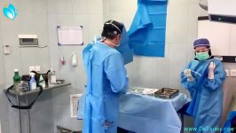 عمليات التجميل الانف في ايران  عملية تجميل الانف في ايران  دكتور تجميل