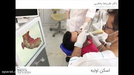 تجربه درمان یک جلسه ای ایمپلنت دیجیتال در دندانپزشکی دیجیتال دکتر رضایی