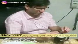 سندروم روده تحريك.مشاوره درماني٠٩١٥٤١٦٥٠٢٧