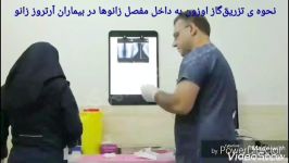 درمان آرتروز زانو تزریق گاز اوزون