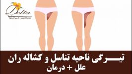 علت تیرگی ناحیه تناسلی راه درمان آن