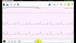 نرم افزار تحلیل سیگنال هولتر ECG نسخه 3 آنالیز