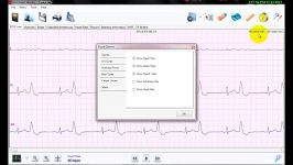 نرم افزار تحلیل سیگنال هولتر ECG نسخه 3 امکانات بصری 3