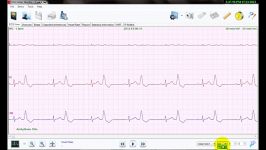 نرم افزار تحلیل سیگنال هولتر ECG نسخه 3  جستجوی سریع