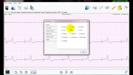 نرم افزار تحلیل سیگنال هولتر ECG نسخه 3 امکانات بصری