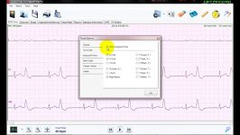 نرم افزار تحلیل سیگنال هولتر ECG نسخه 3 امکانات بصری 2