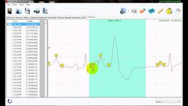 تحلیل PWidth در نرم افزار تحلیل سیگنال هولتر ECG نسخه 3