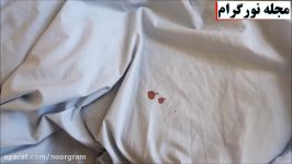 روش پاک کردن لکه خون لباس