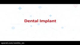 Dental implants plus Iran tours