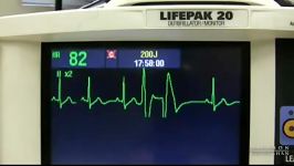 EKG Training Watching Interpreting