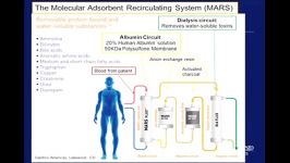 Bioartificial Liver Devices  where does the technology