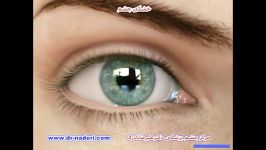 خشکی چشم  مرکز چشم پزشکی دکتر علیرضا نادری