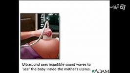 Ultrasound