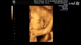 سونوگرافی سه بعدی تصویر قشنگ نگاه کردن جنین