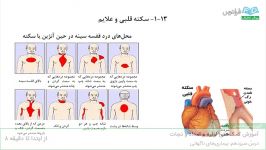 آموزش کمک‌های اولیه امداد نجات درس سیزدهم بیماری‌های ناگهانی