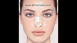 دکتر حسنانی روش صحیح چسب زدن بینی بعد عمل بینی