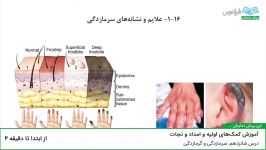 آموزش کمک‌های اولیه امداد نجات درس شانزدهم سرمازدگی گرمازدگی