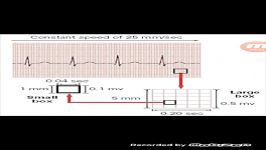 آموزش نوار قلب به زبان ساده ecg قسمت سوم