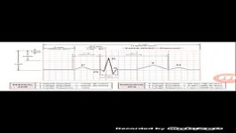 آموزش نوار قلب به زبان ساده ecg قسمت چهارم