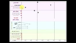 نوار قلب؛ Electrocardiogram