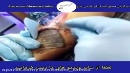 پاک کردن تاتو به وسیلهٔ کندن پوستدانستنی های تاتو