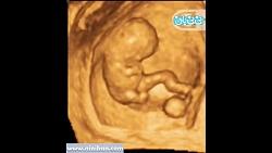 سونوگرافی چهار بعدی در بارداری هفته هفتم
