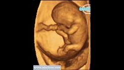 سونوگرافی چهار بعدی در بارداری هفته نهم