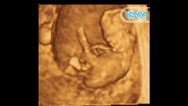 سونوگرافی چهار بعدی در بارداری هفته هشتم