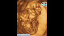 سونوگرافی چهار بعدی در بارداری هفته دهم1