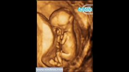 سونوگرافی چهار بعدی در بارداری هفته سیزدهم