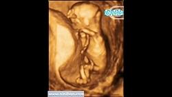 سونوگرافی چهار بعدی در بارداری هفته چهاردهم