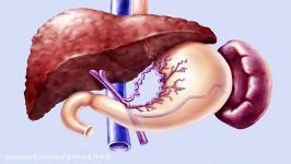 آشنایی باTIPSS Transjugular Intrahepatic Porto Systemic Shunt