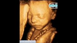 سونوگرافی چهار بعدی در بارداری هفته بیست دوم