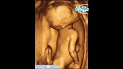 سونوگرافی چهار بعدی در بارداری هفته پانزدهم