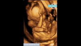 سونوگرافی چهار بعدی در بارداری هفته شانزدهم