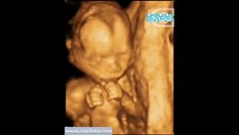 سونوگرافی چهار بعدی در بارداری هفته هفدهم