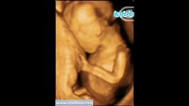 سونوگرافی چهار بعدی در بارداری هفته نوزدهم