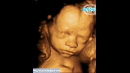 سونوگرافی چهار بعدی در بارداری هفته بیست هفتم