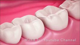 رابطه سلامت دهان دندان لثه سلامتی