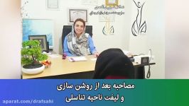 فیلم سفید کردن ناحیه تناسلی همزمان لیفت