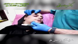 فیلم میکرودرم  دکتر صفائی جراح پوست مو تهران