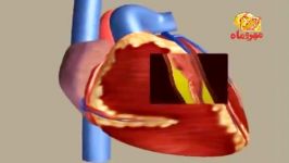 mi  سكته قلبی