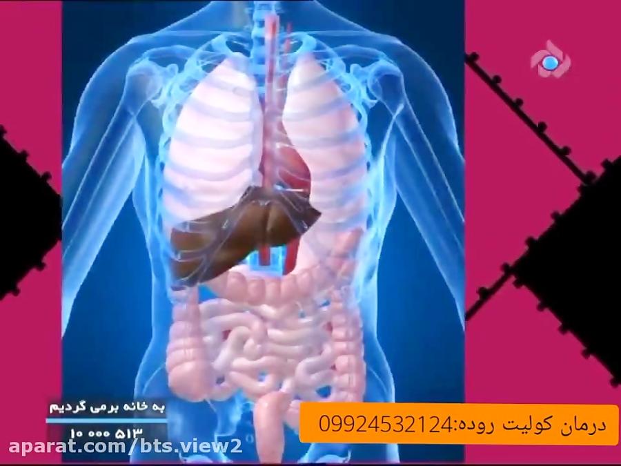 ایا میدانستید کولیت روده منجر به سرطان میشود؟