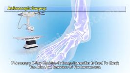 آرتروسکوپی مفصل مچ پا Ankle Joint Arthroscopy